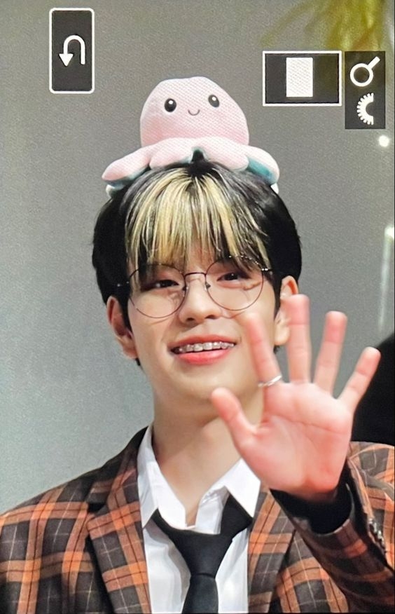 seungmin braces.jpg